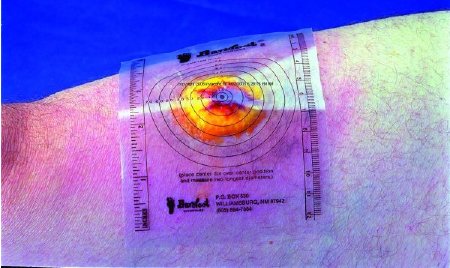 MEASURE GUIDE, DECUB DISP (250/BX)