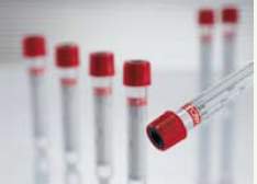 TUBE, BLD COL CLOT RED/BLK 9MLPET VACUETTE (50/PK 24PK/CS)