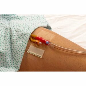 HOLDER, CATHETER FOLEY ONE-SIZE (50/BX)