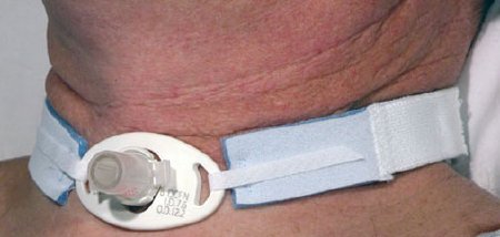HOLDER, TRACH TUBE NEO (10/BX 10BX/CS) CARFUS